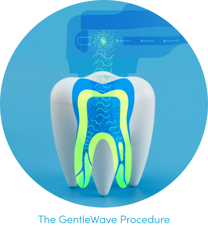 GentleWave Procedure Mechanism of Action