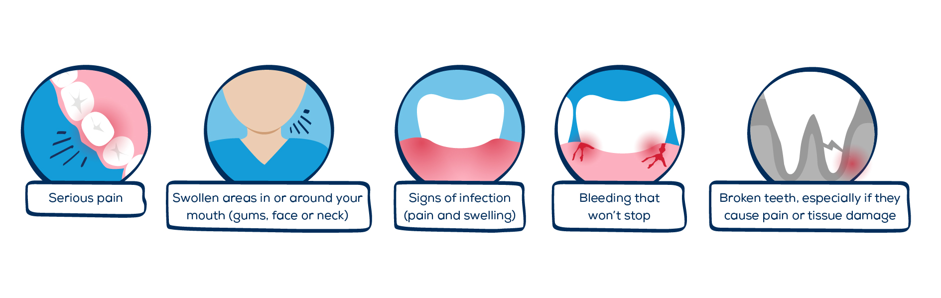 Symptoms of Endodontic Issues