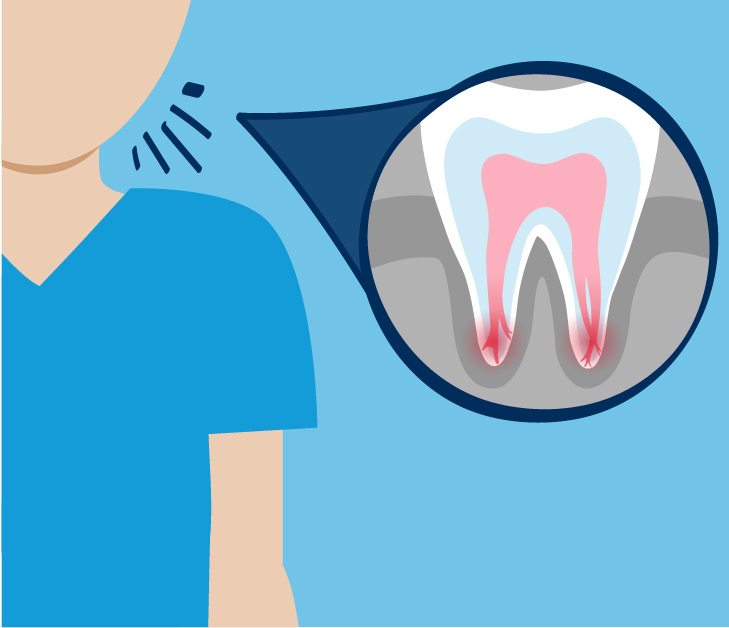 Why do I need to treat my root canal system infection?