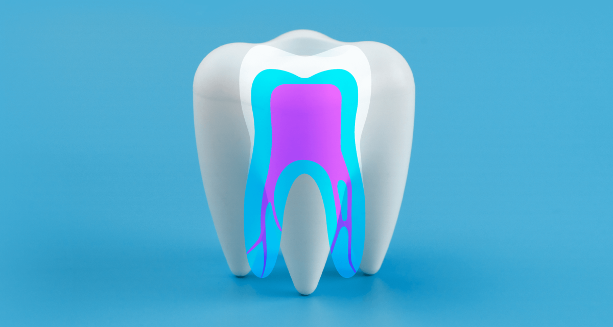 The Main Causes of Root Canal Infections