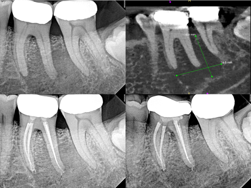 Guarded Pre-Op with Healing Evidence