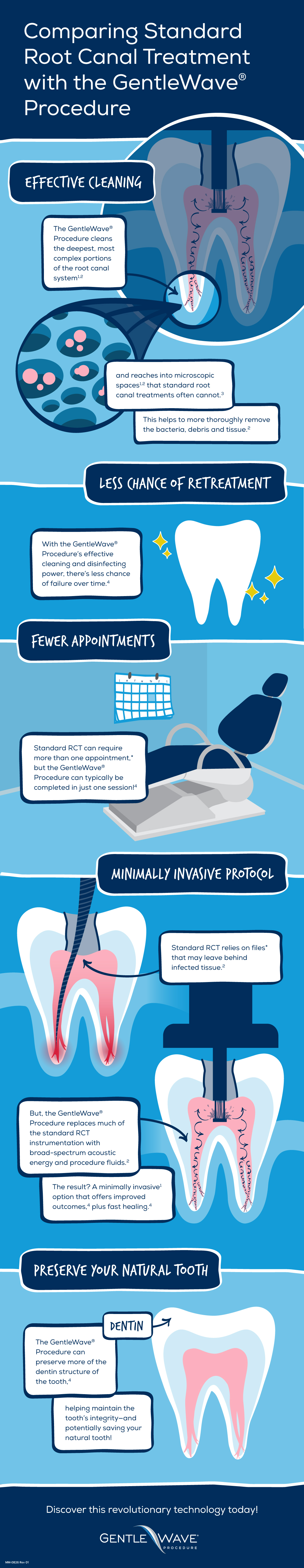 Comparing Standard RCT with the GentleWave Procedure