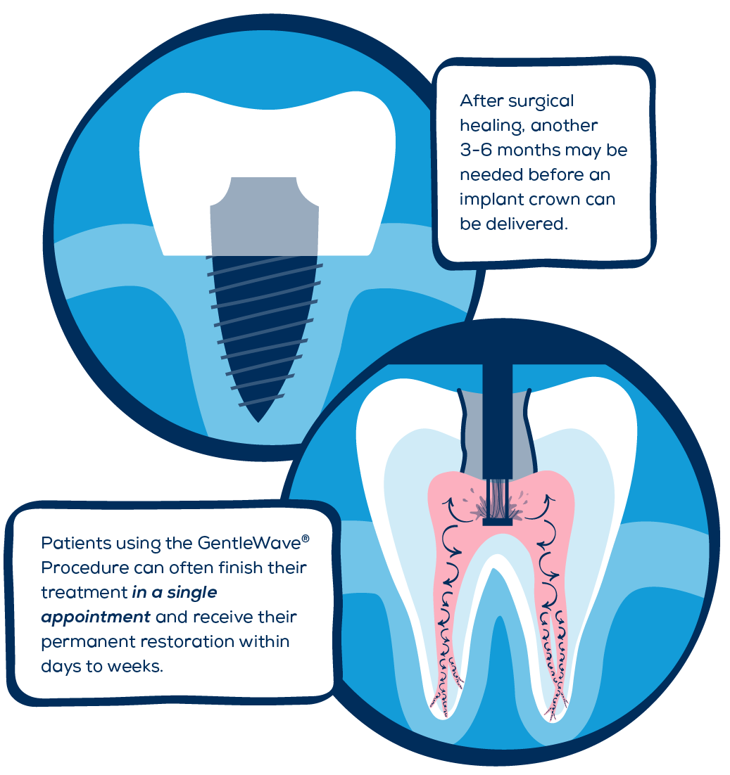 Comparing Healing for Dental Implants and the GW Procedure