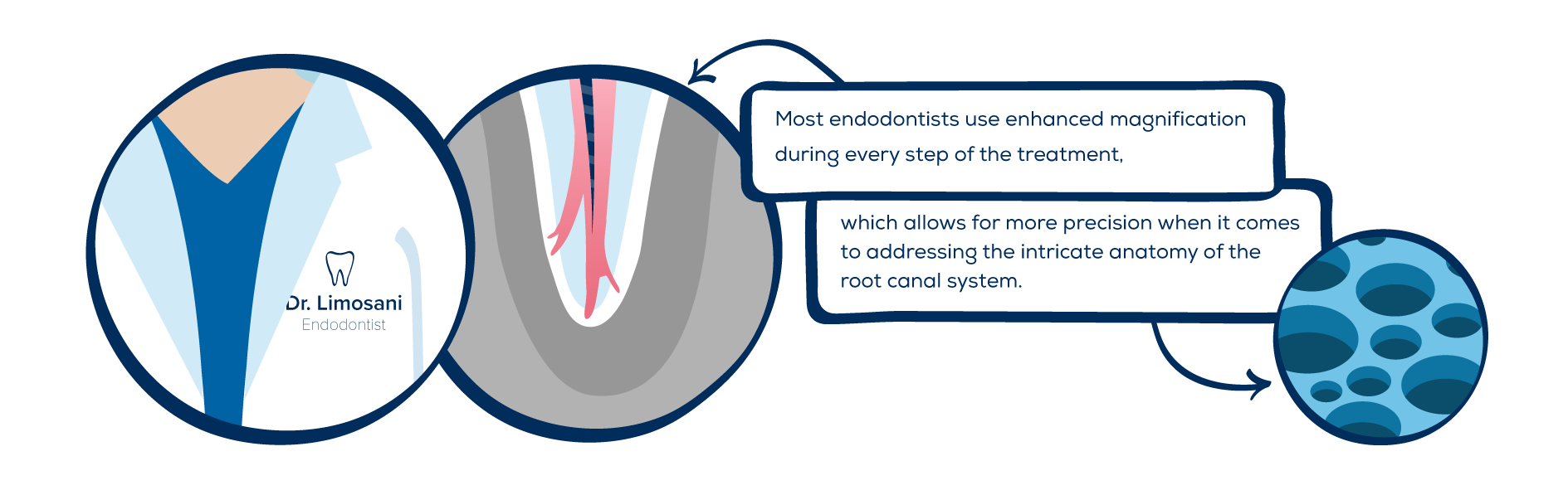 Endodontists vs. Dentist
