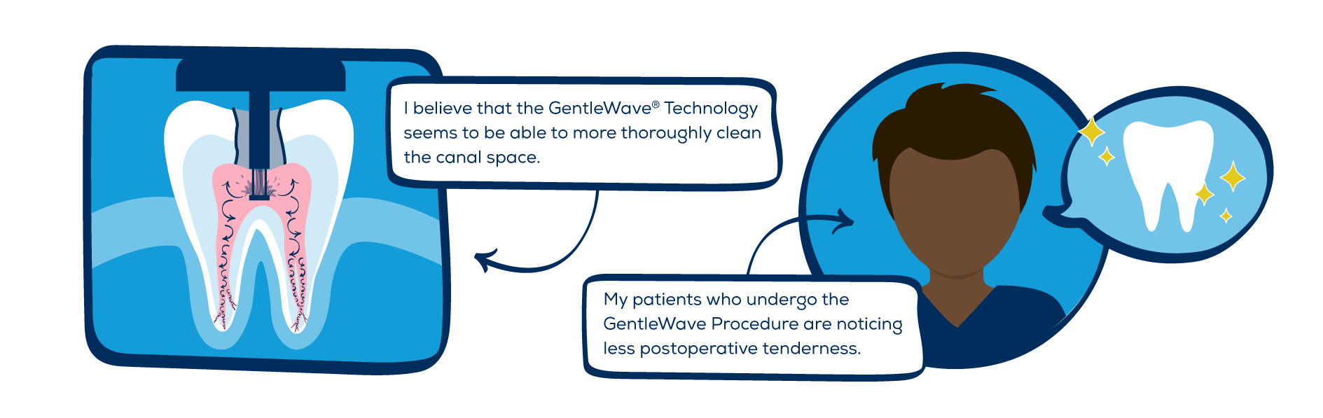 Advantages of the GentleWave Procedure