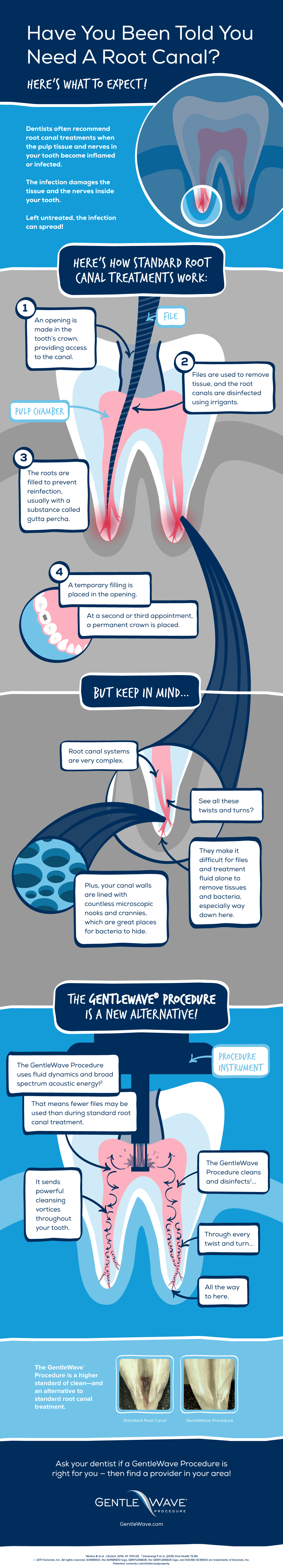 what is endodontics | GentleWave Procedure