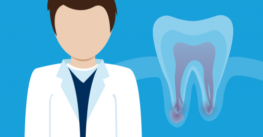 Ask the Endodontists | Understanding RCT 