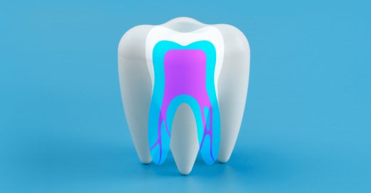 The Main Causes of Root Canal Infections