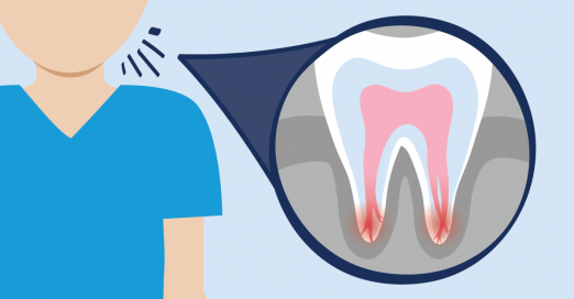 root canal advancements