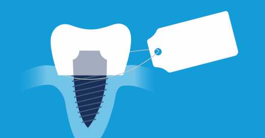How much do dental implants cost?